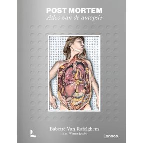 Post mortem. Atlas van de autopsie